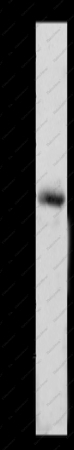 MMP17 Polyclonal Antibody - 1
