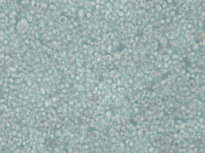 SU-DHL-2 Cell Complete Medium - small - 4