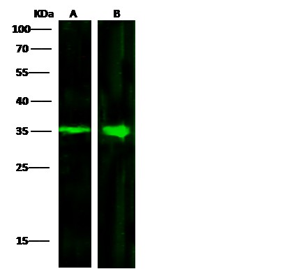 ACBD6 Monoclonal Antibody - small - 2