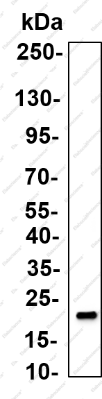 Recombinant ID4 Monoclonal Antibody - 3