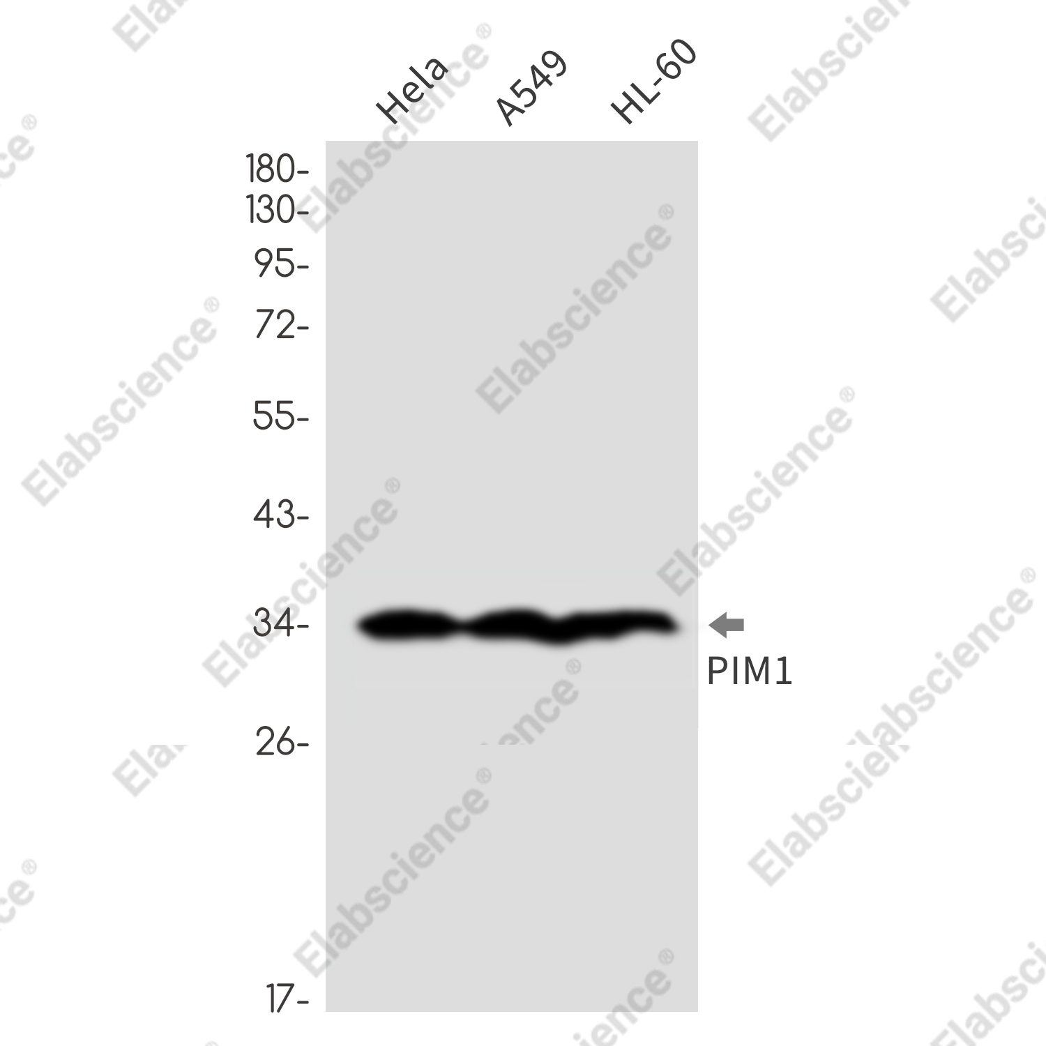 Recombinant PIM1 Monoclonal Antibody - 1