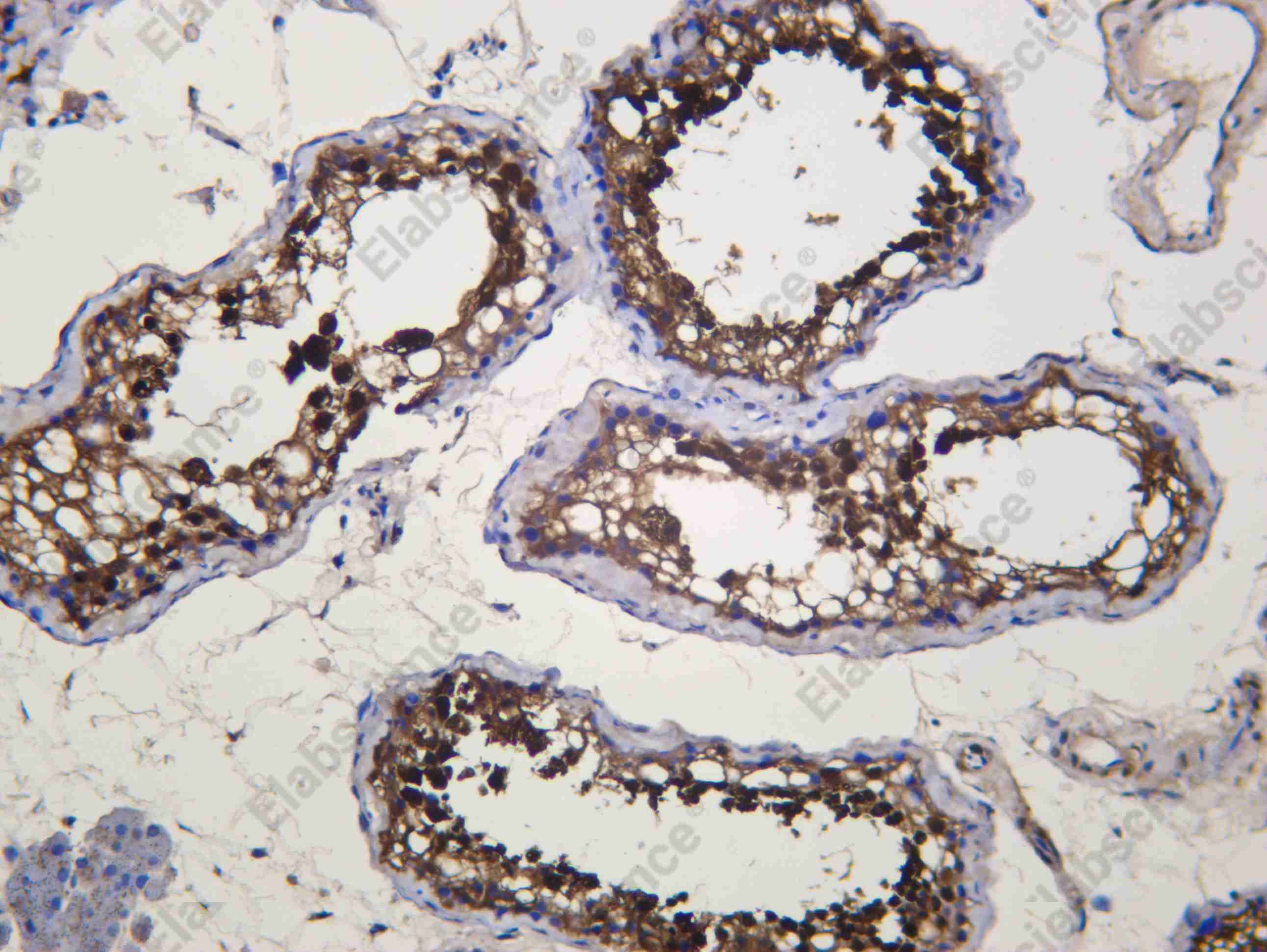 Recombinant HSP72 Monoclonal Antibody - 2