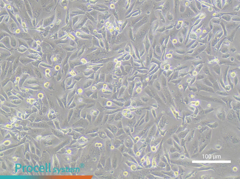 OV56 Cell Complete MediumOV56 Cell Complete Medium - 1