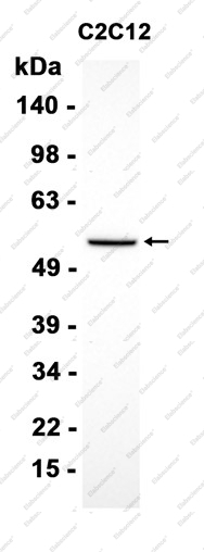 Recombinant Peripherin Monoclonal Antibody - 2