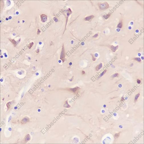 Recombinant Dynamin 1 Monoclonal Antibody - 2