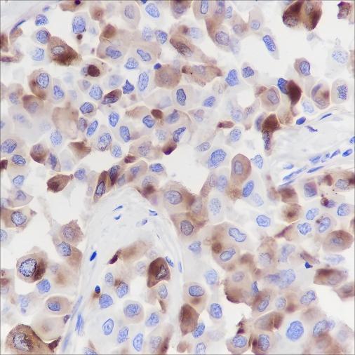 Recombinant GCDFP-15 Monoclonal Antibody - 2