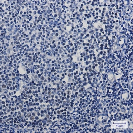 Recombinant MBD2 Monoclonal Antibody - 2