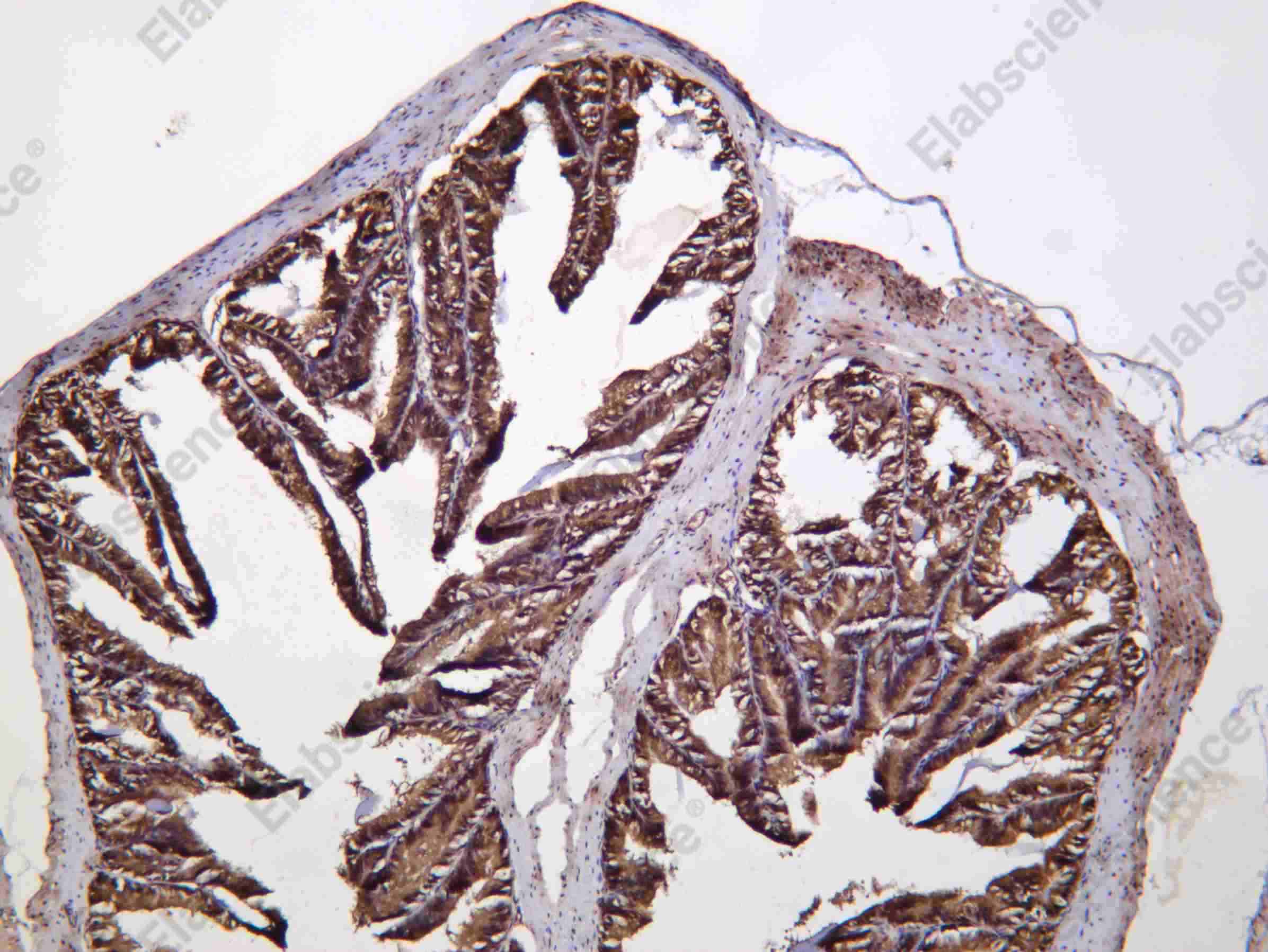 Recombinant BMX Monoclonal Antibody - 3