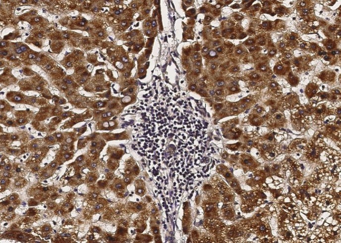 Recombinant ACOX1/AOX Monoclonal Antibody - small - 1