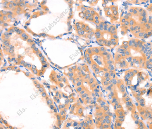 PRDX2 Polyclonal Antibody - 3