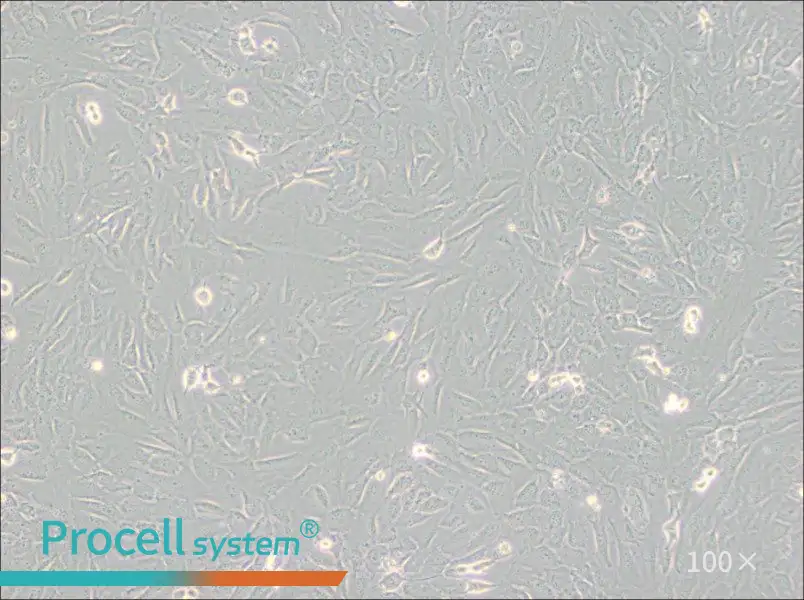 SJSA-1 Cell Complete Medium - 1