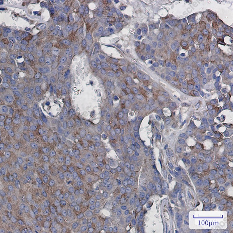 Recombinant RAC3 Monoclonal Antibody - 2