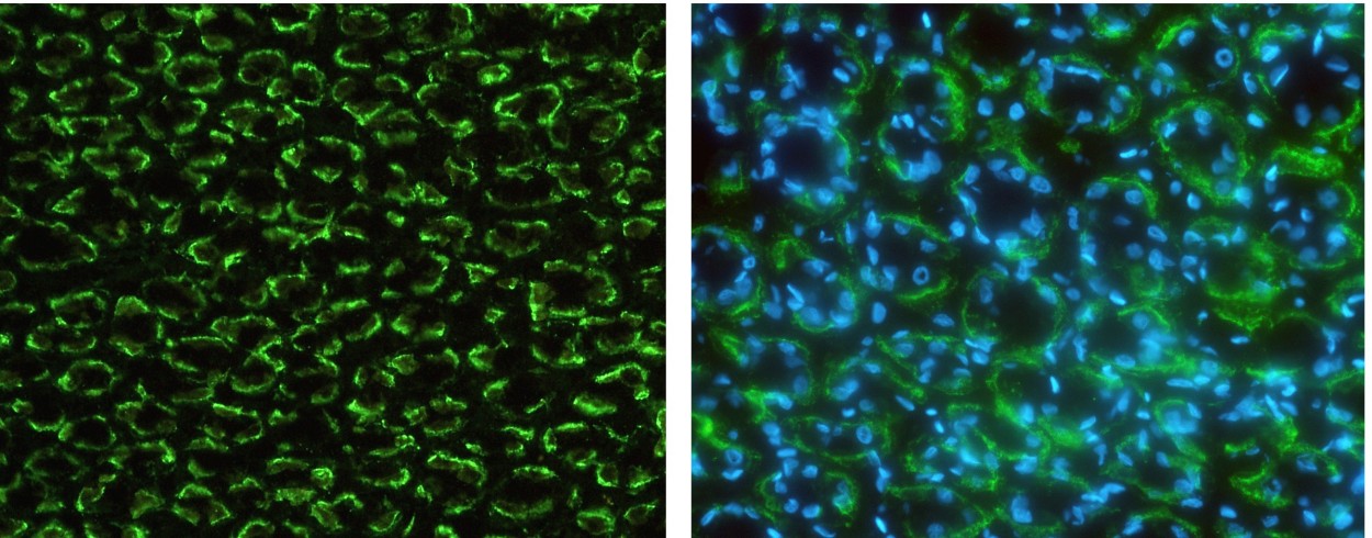 Recombinant CD147/EMMPRIN/Basigin Monoclonal Antibody - small - 3