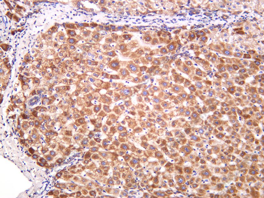 Recombinant IFNGR1/CD119/IFN-gamma-R1 Monoclonal Antibody - 5