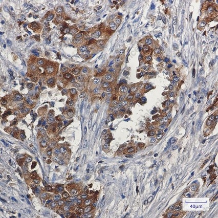 Recombinant Niemann Pick C2 Monoclonal Antibody - 2