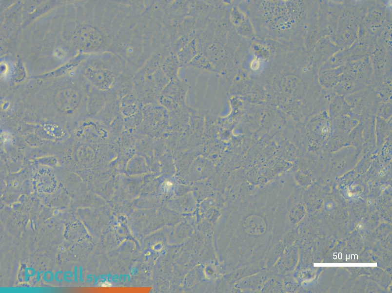 NCI-H1838 - 6