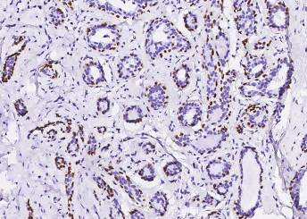 Recombinant p63(alpha) Monoclonal Antibody - small - 3