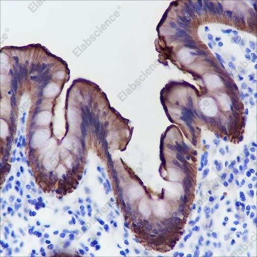 Recombinant Villin Monoclonal Antibody - 2