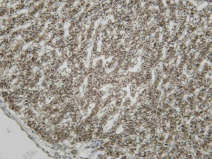 Recombinant SIGMAR1 Monoclonal Antibody - 2