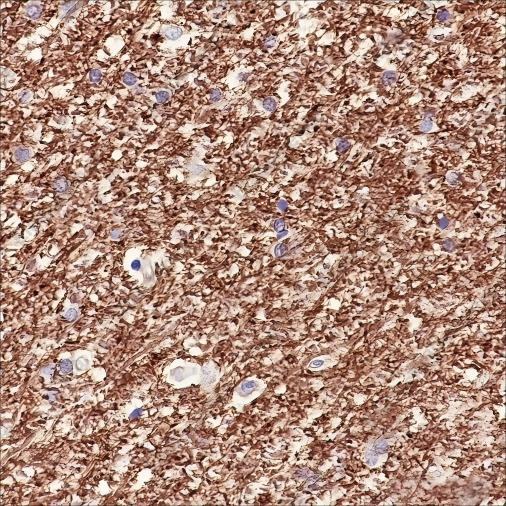Recombinant MAG Monoclonal Antibody - 2