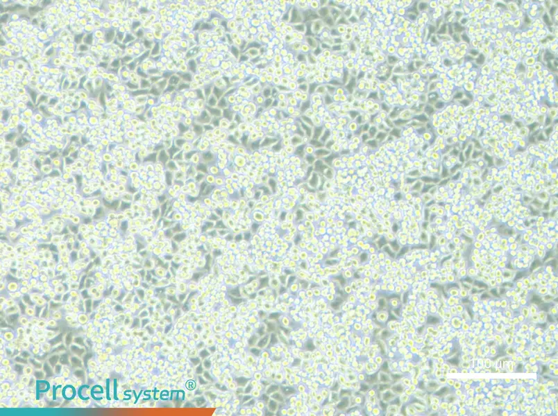 NCI-H2122NCI-H2122 - 2