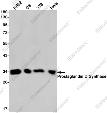 Recombinant Prostaglandin D Synthase Monoclonal Antibody - 1