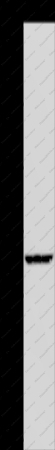 IVL Polyclonal Antibody - 1