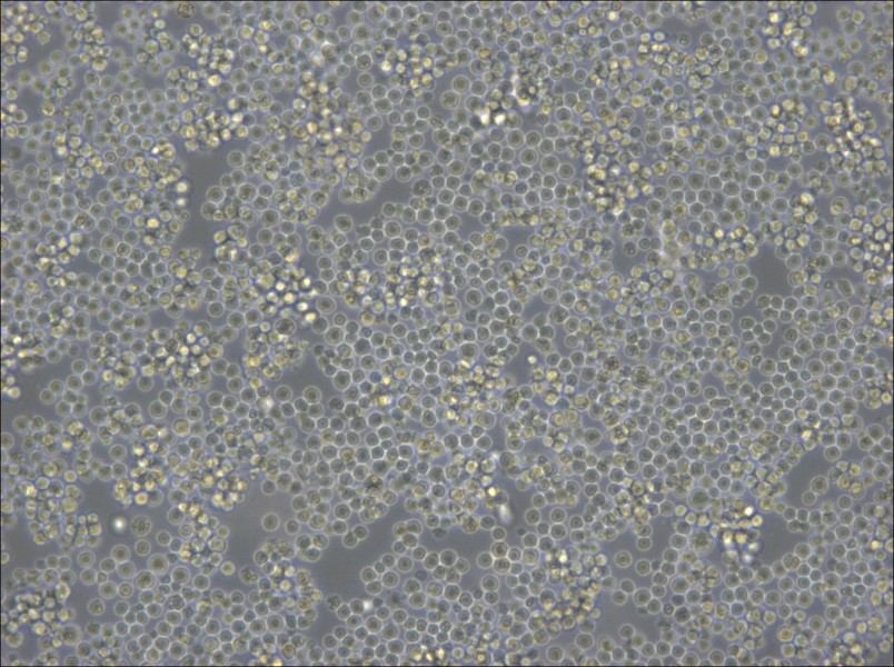 DoHH2 Cell Complete Medium - 5