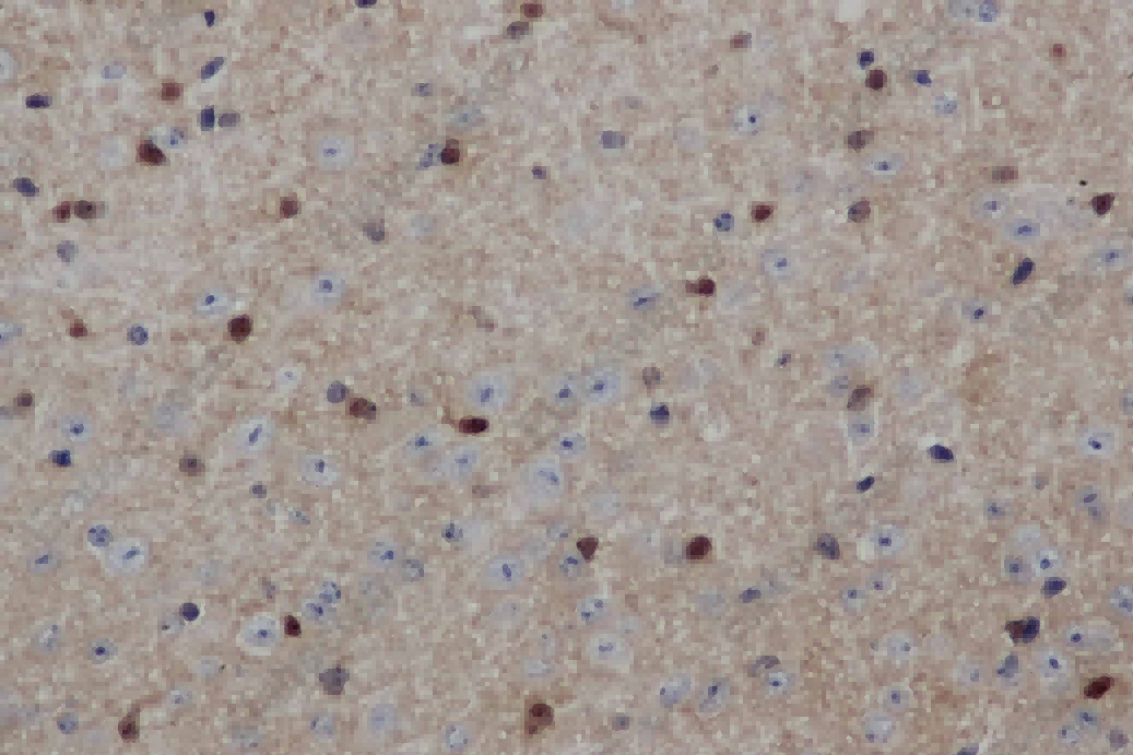 ENO1 Polyclonal Antibody - 2