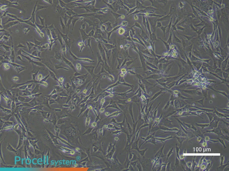 Mouse Hepatic Stellate Cells (Primary cell immortalization) - 1