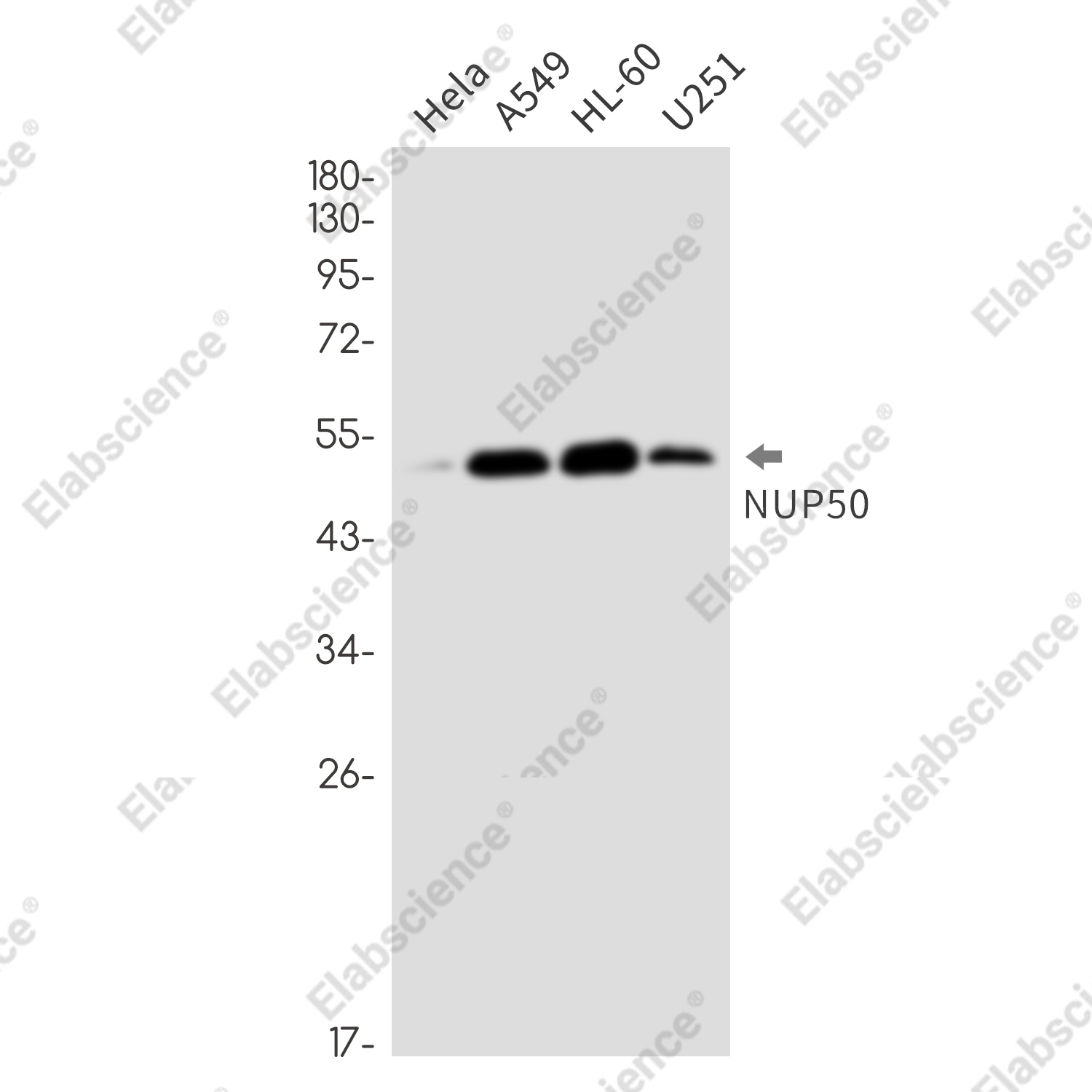 Recombinant NUP50 Monoclonal Antibody - 1