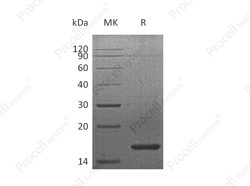 FGF-7/KGF, Human, Recombinant