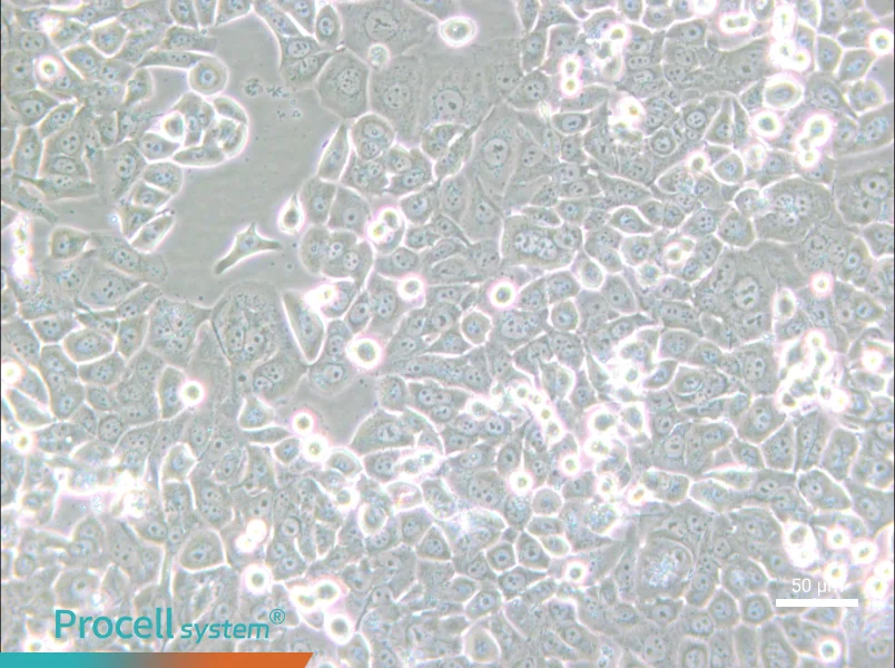 NCI-H2126 - 4