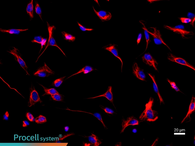 Mouse Cardiac FibroblastsMouse Cardiac Fibroblasts - 2
