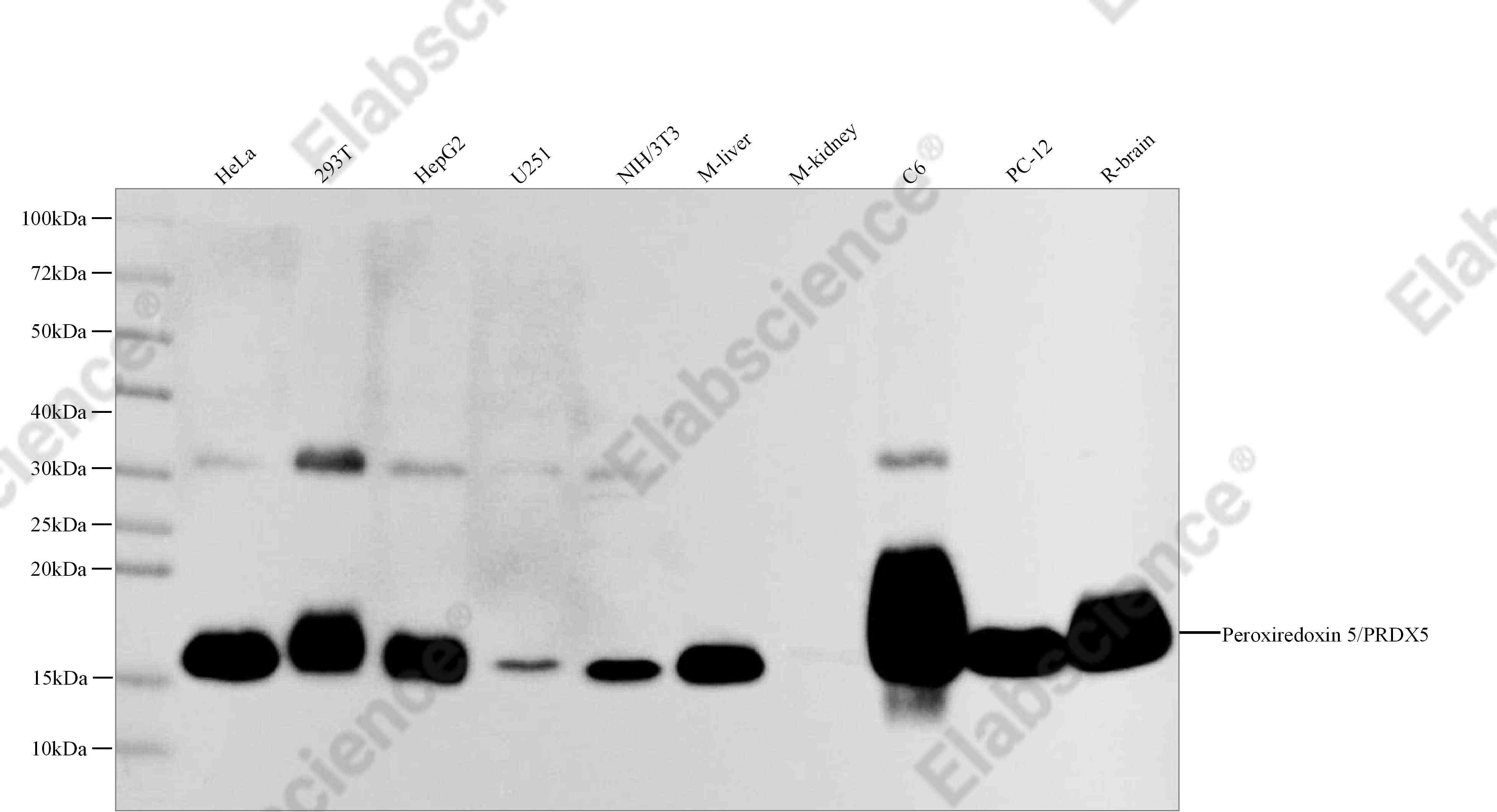 Recombinant Peroxiredoxin 5/PRDX5 Monoclonal Antibody - 1