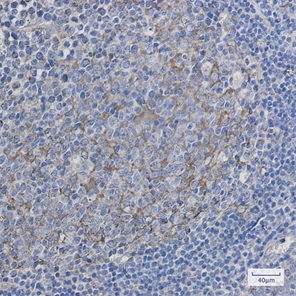 Recombinant Citrate Synthetase Monoclonal Antibody - 3