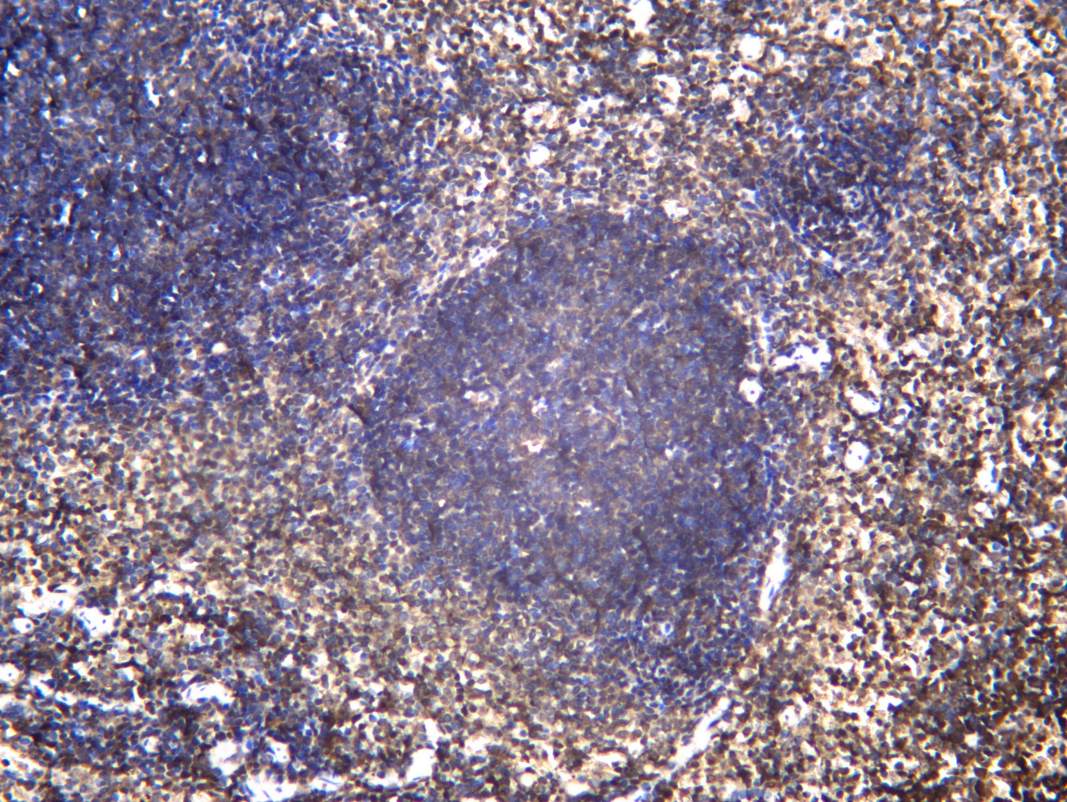 Recombinant CD272 Monoclonal Antibody - 1