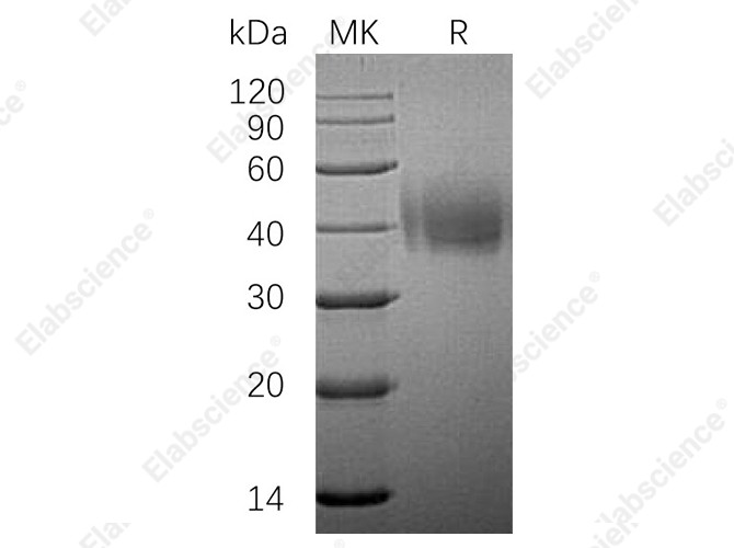 Recombinant Human SLAMF7/CD319 Protein (His Tag) - 1