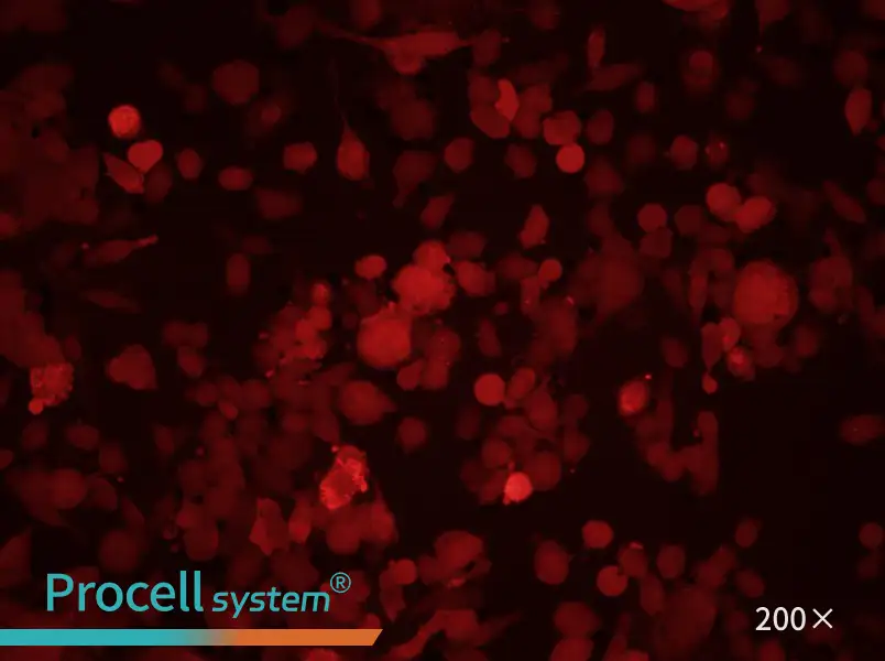 PC-3-RFP Cell Complete Medium - 3