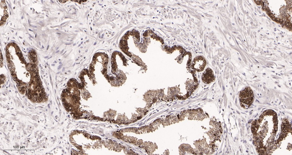 Recombinant Hsp70 Monoclonal Antibody - small - 2