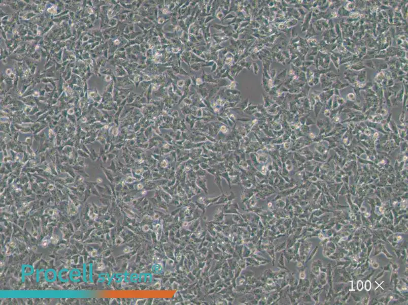 Kelly Cell Complete Medium - 1