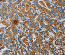UPF1 Polyclonal Antibody - 3