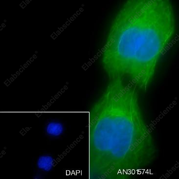 Recombinant Keratin 15 Monoclonal Antibody - 8
