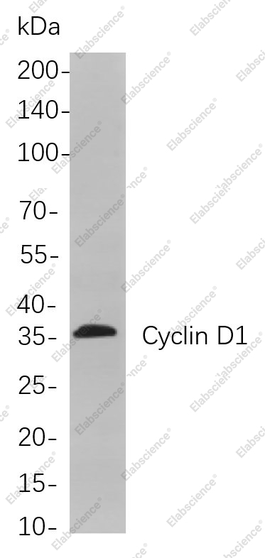 Recombinant Cyclin D1 Monoclonal Antibody - 1