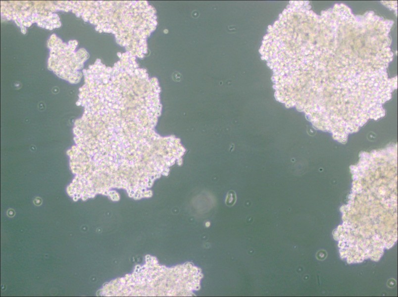 NCI-H146 [H146] Cell Complete Medium - small - 5