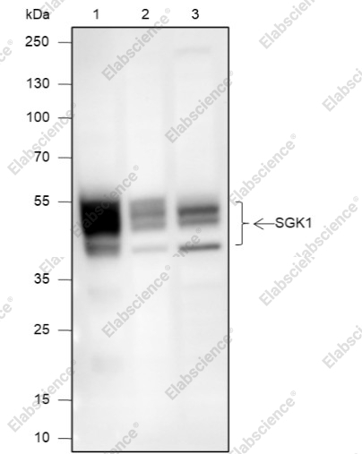 Recombinant SGK1 Monoclonal Antibody - 1