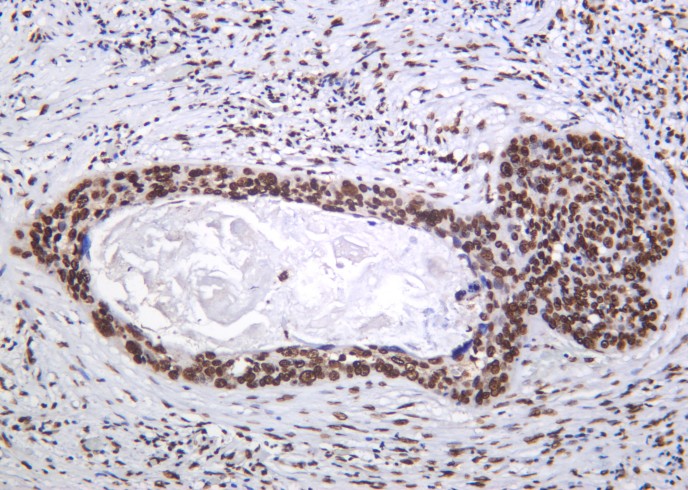 Recombinant Histone H4 (Acetyl Lys5) Monoclonal Antibody-searchlist-1