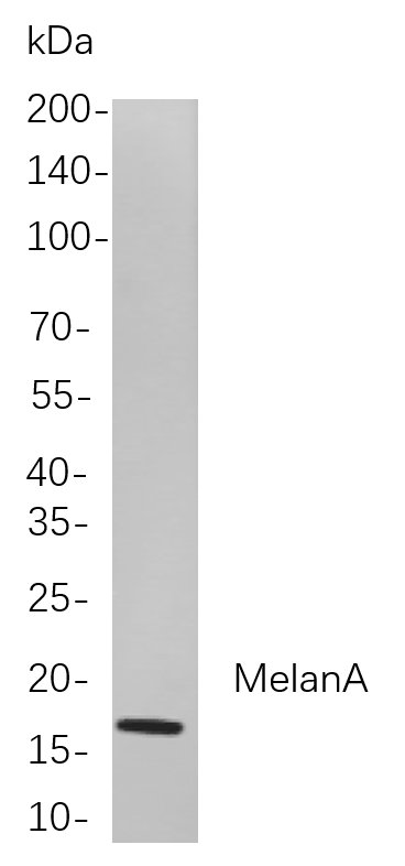 Recombinant MelanA Monoclonal Antibody-searchlist-1
