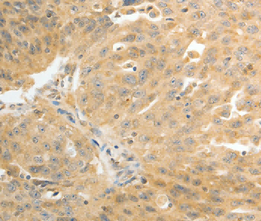 AKR1C1 Polyclonal Antibody - 3
