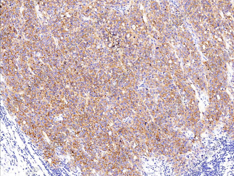 Recombinant EpCAM/TROP-1/TACSTD1 Monoclonal Antibody - 1